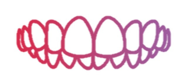 clear-aligners-for-crossbite-teeth-treatment-in-tamilnadu-big-0