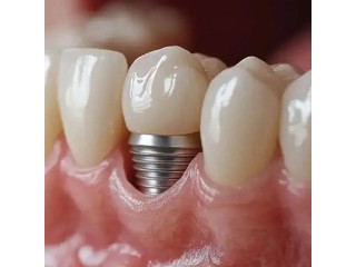 Kalaa Dental Care - Best Dental Clinic in Kodambakkam, Chennai